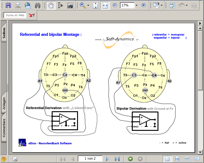 Neurofeedback - PDF : referential and bipolar Montage